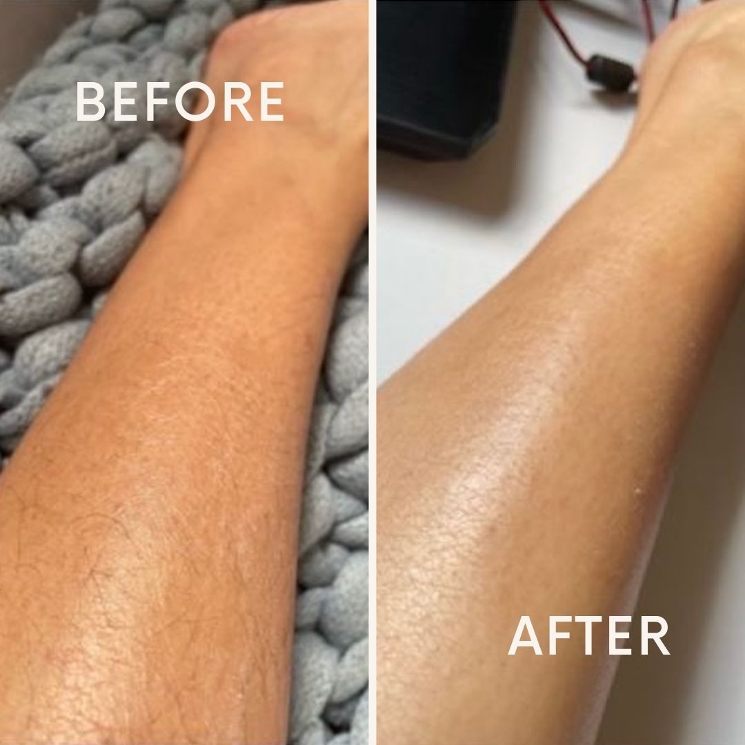 Shea Butter & HA + Vit E Balm