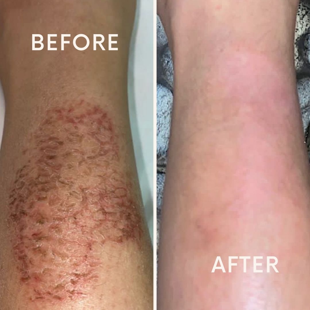 The Dream Team - HA & Retinol Balm