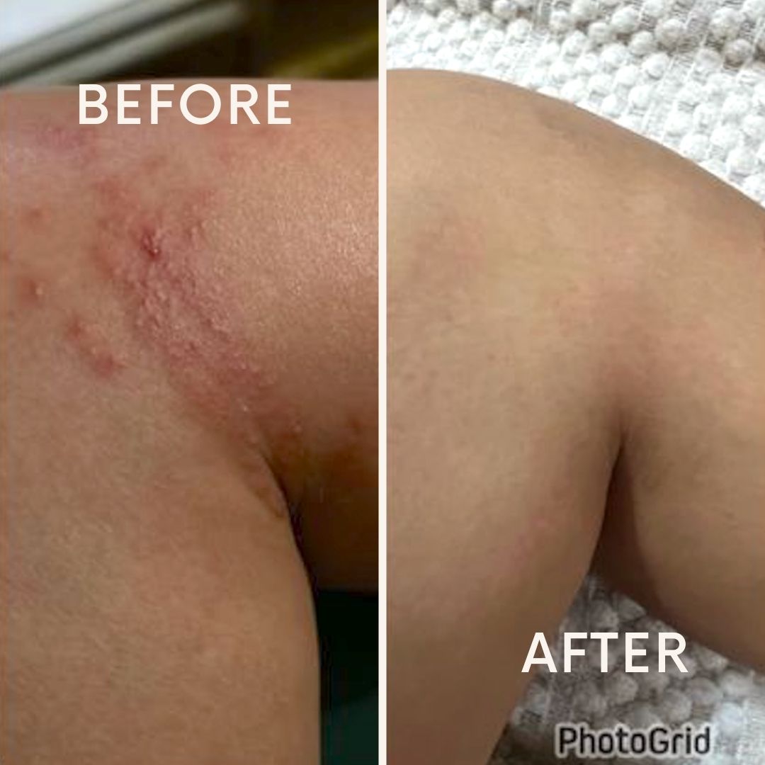 Shea Butter & HA + Vit E Balm