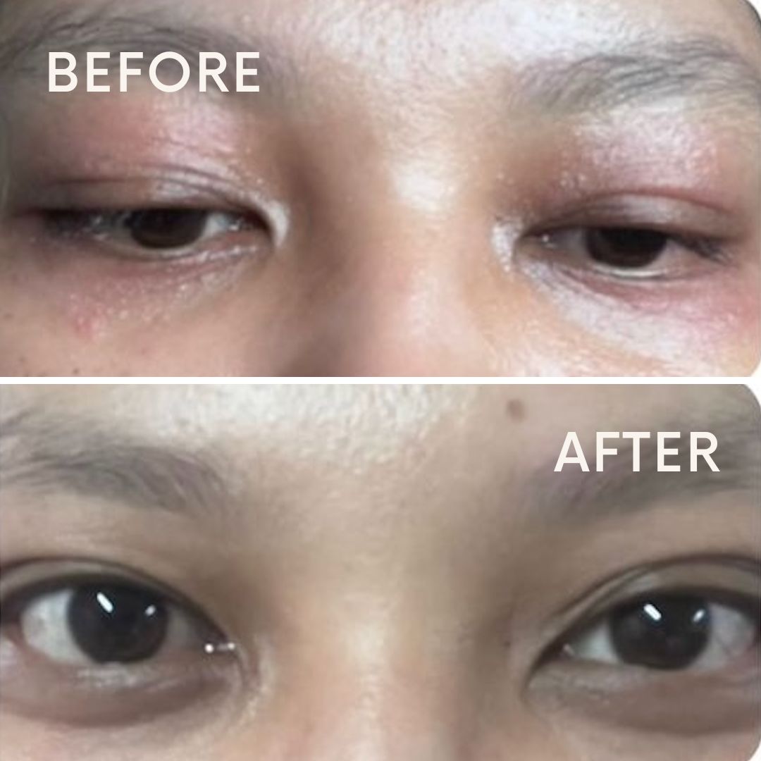 Shea Butter & HA + Vit E Balm