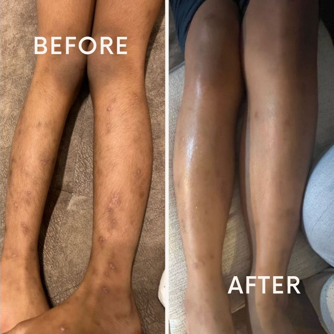 The Dream Team - HA & Retinol Balm