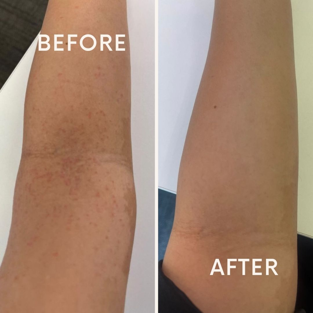 Shea Butter & Retinol Balm