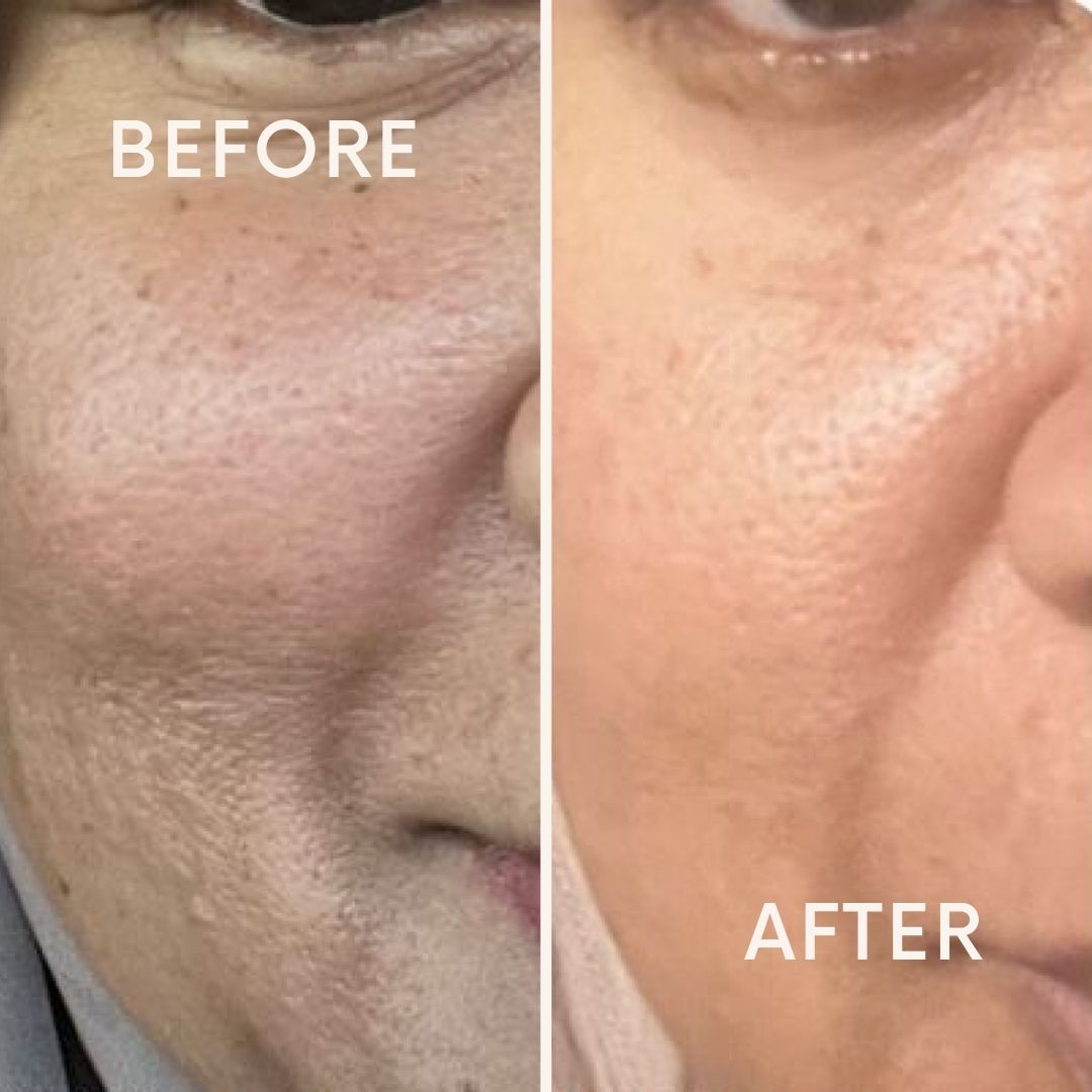 Shea Butter & Retinol Balm