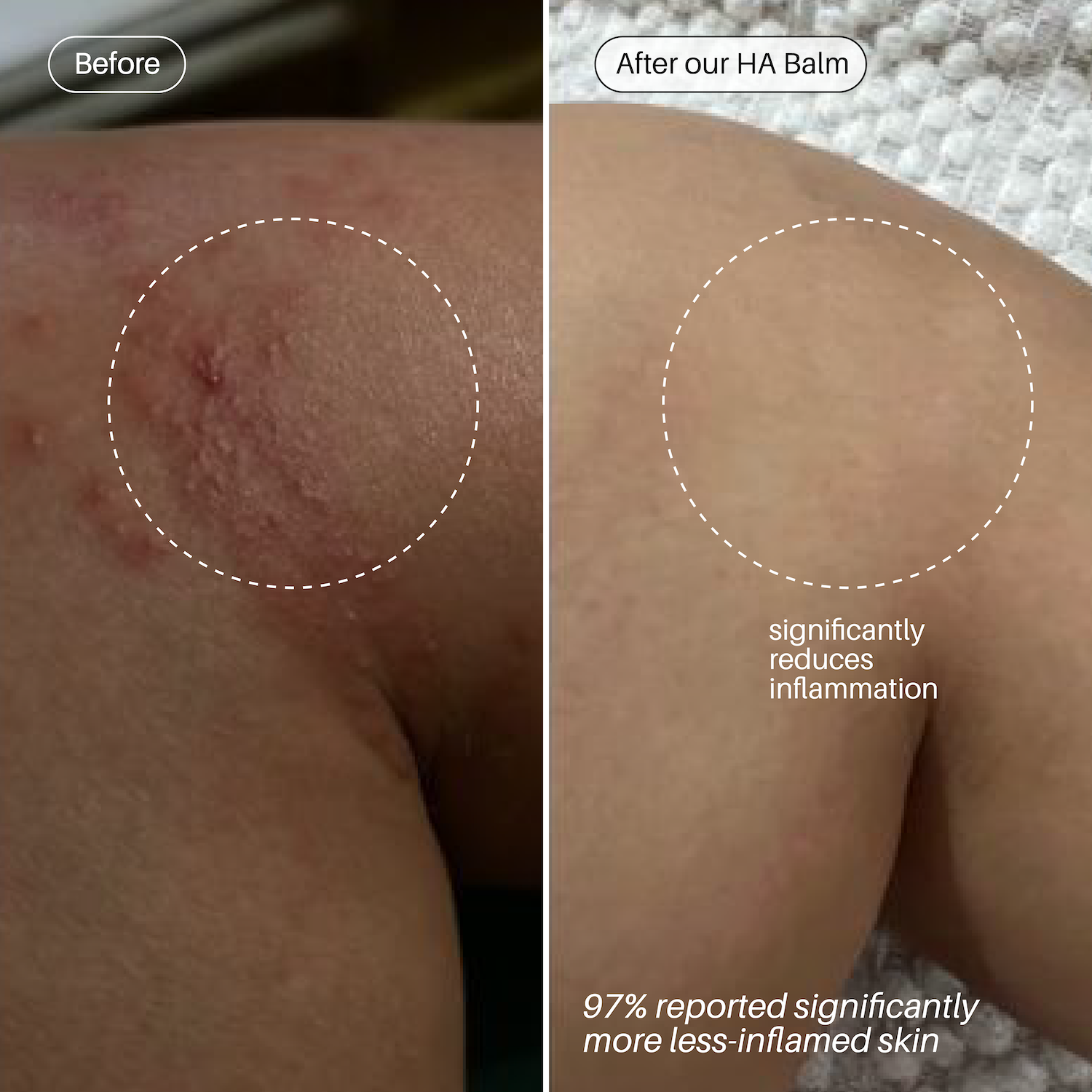The Dream Team - HA & Retinol Balm - Ulu Soleil