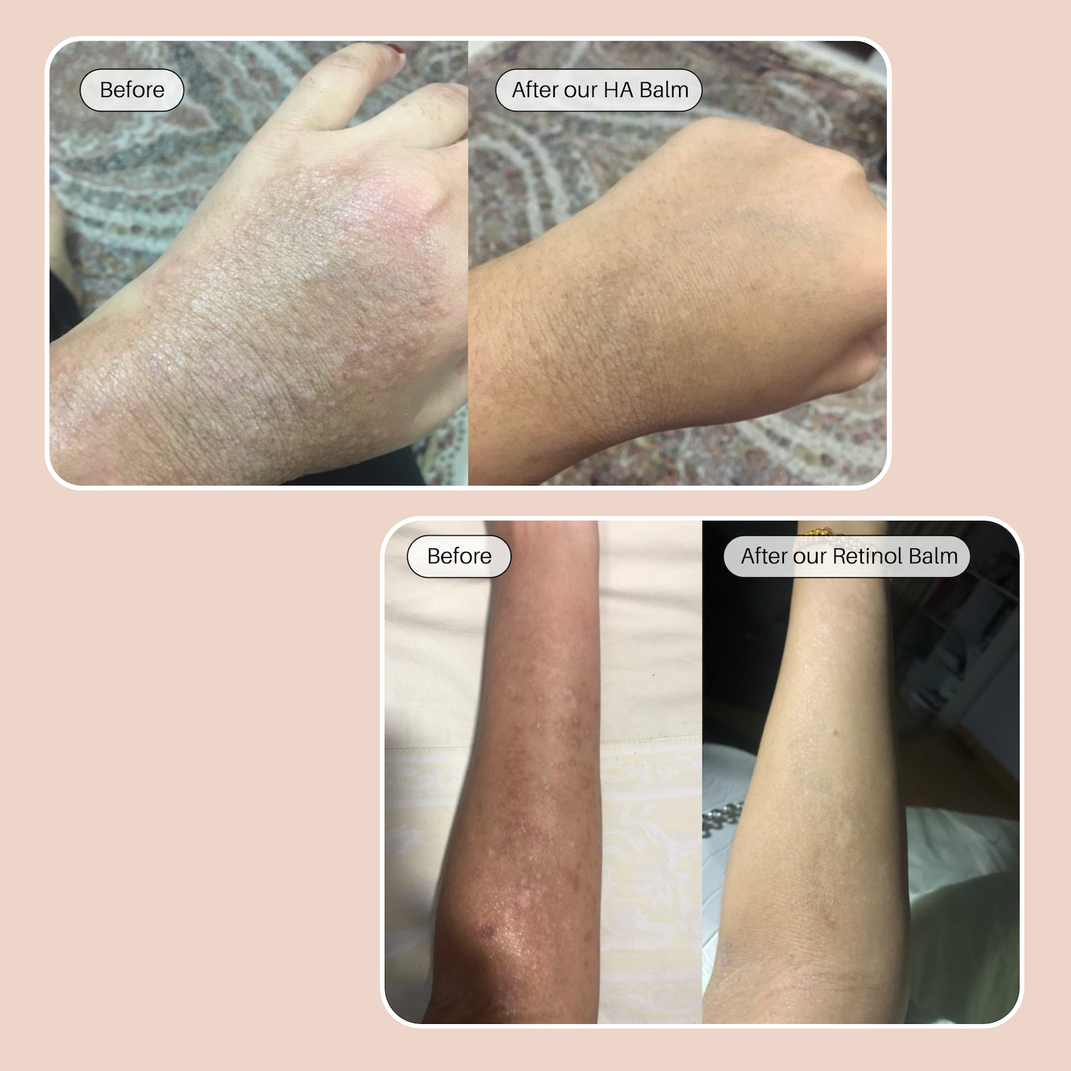 The Dream Team - HA & Retinol Balm - Ulu Soleil