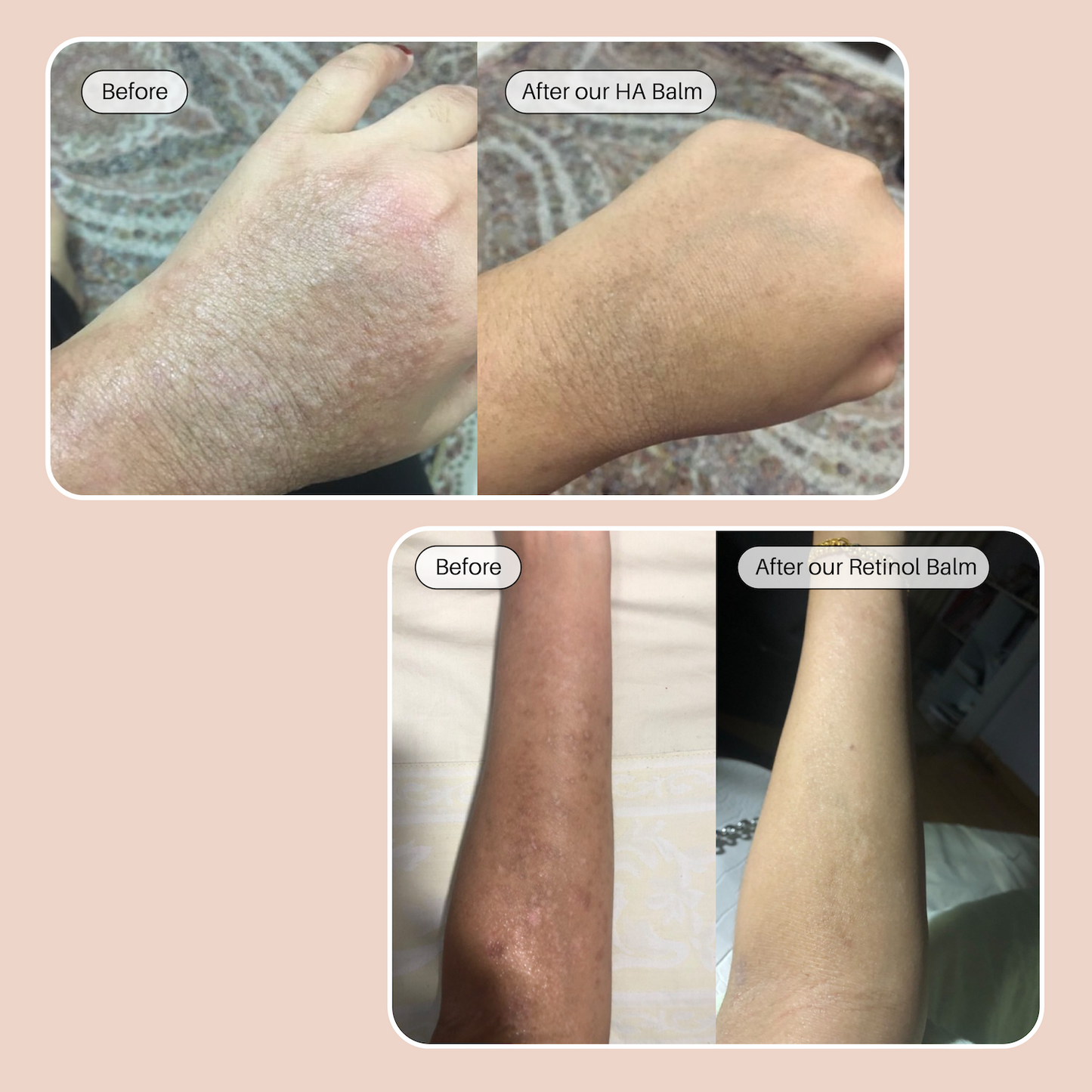 The Dream Team - HA & Retinol Balm - Ulu Soleil