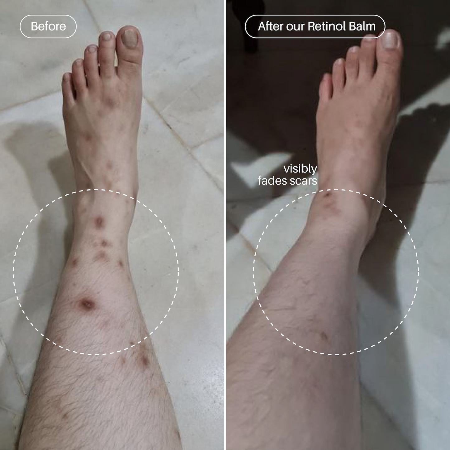 KP Kit - AHA Scrub & Retinol Bundle - Ulu Soleil